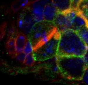 a microscopic image shows bands of red, yellow, green and blue lights during the process of cell division.